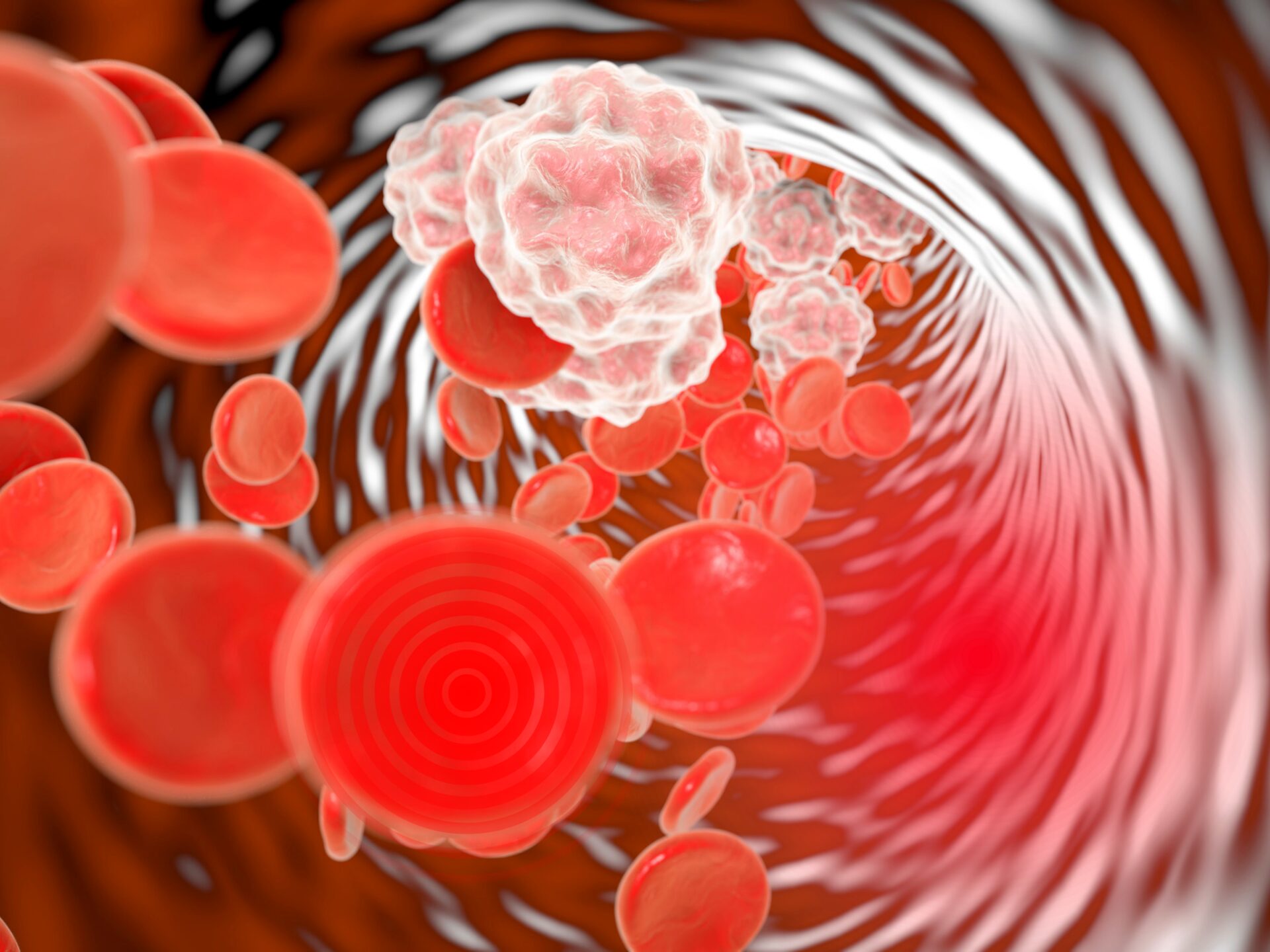 what is inflammation