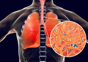 Herbs for Coughs